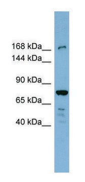 Anti-DAPK1 (N-terminal) antibody produced in rabbit affinity isolated antibody