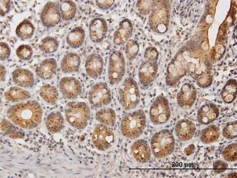 Anti-UGT1A9 antibody produced in mouse IgG fraction of antiserum, buffered aqueous solution