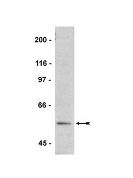 Anti-Phospho-VASP(Ser239)-Antikörper, Klon 16C2 clone 16C2, Upstate&#174;, from mouse