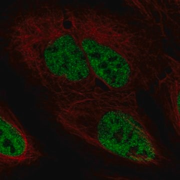 Anti-PPP4R2 antibody produced in rabbit Prestige Antibodies&#174; Powered by Atlas Antibodies, affinity isolated antibody