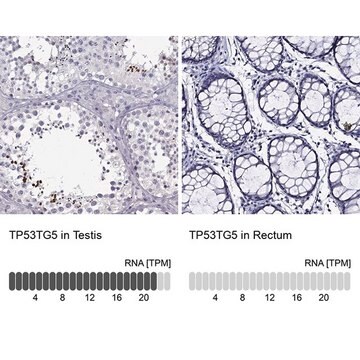 Anti-TP53TG5 antibody produced in rabbit Prestige Antibodies&#174; Powered by Atlas Antibodies, affinity isolated antibody, buffered aqueous glycerol solution