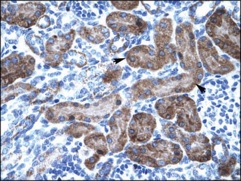 抗TRIM31 兔抗 affinity isolated antibody