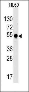 Anti-MYT1 (C-term) antibody produced in rabbit affinity isolated antibody, buffered aqueous solution