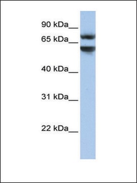 Anti-JPH3 antibody produced in rabbit affinity isolated antibody