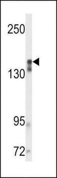 ANTI-VGFR2 antibody produced in rabbit purified immunoglobulin, buffered aqueous solution