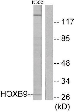 Anti-HOXB9 antibody produced in rabbit affinity isolated antibody