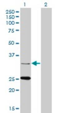 Monoclonal Anti-STAR antibody produced in mouse clone 5F9, purified immunoglobulin, buffered aqueous solution