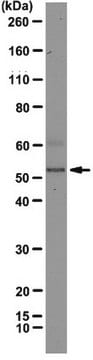 Anti-hnRNP F Antibody, clone 3H4 clone 3H4, from mouse