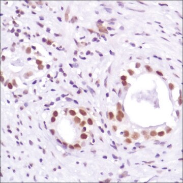 Anti-Androgen Receptor (C-term) antibody, Rabbit monoclonal recombinant, expressed in proprietary host, clone SP224, affinity isolated antibody