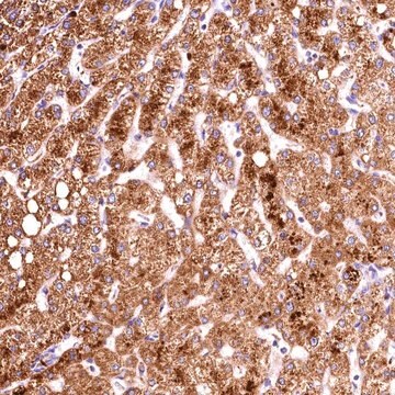 Anti-ACAA2 antibody produced in rabbit Prestige Antibodies&#174; Powered by Atlas Antibodies, affinity isolated antibody, buffered aqueous glycerol solution