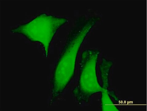 Anti-CALU antibody produced in mouse purified immunoglobulin, buffered aqueous solution