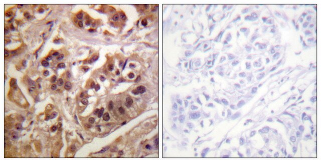 Anti-IKK-&#947; antibody produced in rabbit affinity isolated antibody