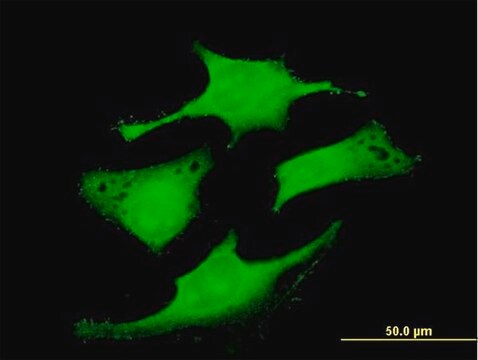 Anti-RAB6IP1 antibody produced in mouse purified immunoglobulin, buffered aqueous solution