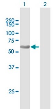 Anti-SQSTM1 Mouse pAb liquid, Calbiochem&#174;