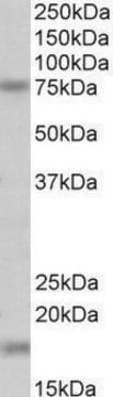 Anti-TGM7 antibody produced in goat affinity isolated antibody, buffered aqueous solution