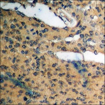 Anti-phospho-Cyclin D1 (pThr286) antibody produced in rabbit affinity isolated antibody