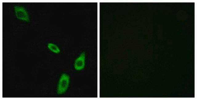 Anti-ADRA1B antibody produced in rabbit affinity isolated antibody