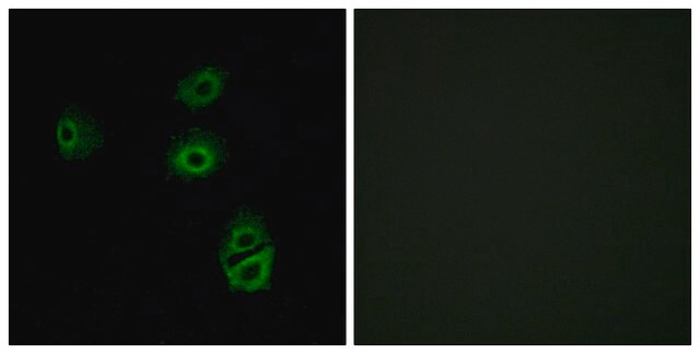 Anti-OR2B2 antibody produced in rabbit affinity isolated antibody