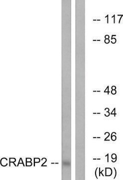 Anti-CRABP2 antibody produced in rabbit affinity isolated antibody