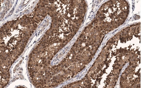 Anti-FKBP52 Antibody, clone 4H21 ZooMAb&#174; Rabbit Monoclonal recombinant, expressed in HEK 293 cells