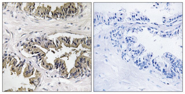 Anti-GSPT1 antibody produced in rabbit affinity isolated antibody