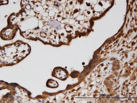 Monoclonal Anti-HECTD2 antibody produced in mouse clone 3D6, purified immunoglobulin, buffered aqueous solution