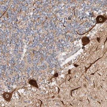 Anti-CEP295NL antibody produced in rabbit Prestige Antibodies&#174; Powered by Atlas Antibodies, affinity isolated antibody, buffered aqueous glycerol solution, ab2