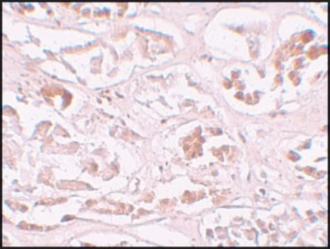 Anti-ALKBH2 antibody produced in rabbit affinity isolated antibody, buffered aqueous solution