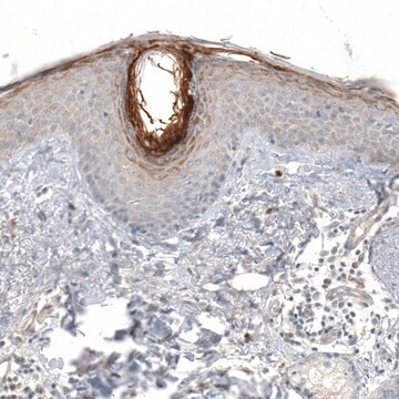 Anti-HRNR antibody produced in rabbit Prestige Antibodies&#174; Powered by Atlas Antibodies, affinity isolated antibody, buffered aqueous glycerol solution