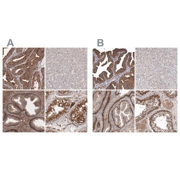 Anti-ENAH antibody produced in rabbit Prestige Antibodies&#174; Powered by Atlas Antibodies, affinity isolated antibody, buffered aqueous glycerol solution, ab1