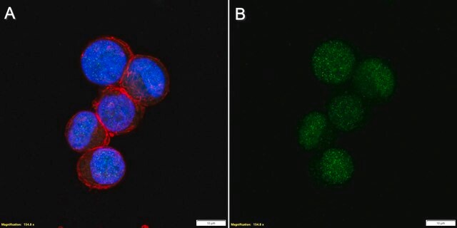 Anti-GATA1 Antibody, clone 1D3 ZooMAb&#174; Rabbit Monoclonal recombinant, expressed in HEK 293 cells