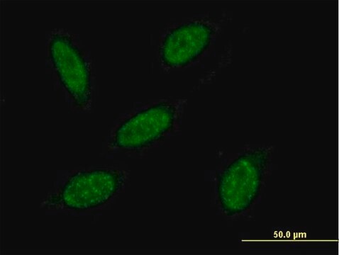 Anti-RNF20 antibody produced in mouse purified immunoglobulin, buffered aqueous solution