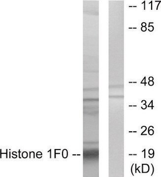 Anti-Histone 1F0 antibody produced in rabbit affinity isolated antibody