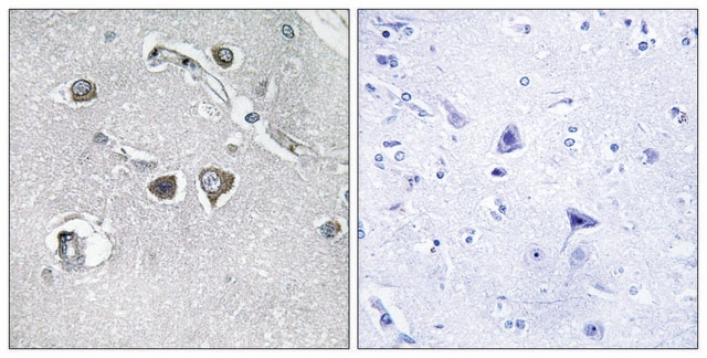 Anti-Collagen XI &#945;2 antibody produced in rabbit affinity isolated antibody