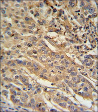 ANTI-F91A1 (N-TERM) antibody produced in rabbit IgG fraction of antiserum, buffered aqueous solution