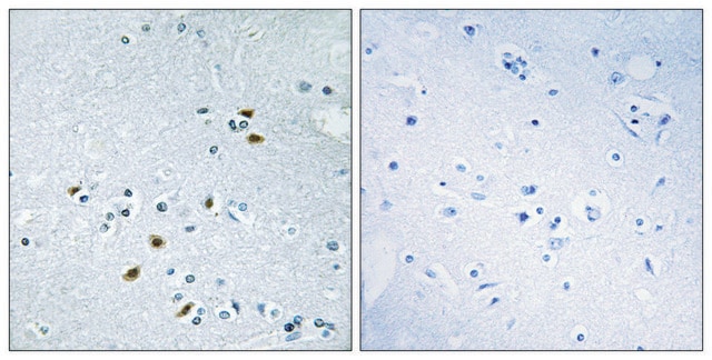 Anti-BRCA2 antibody produced in rabbit affinity isolated antibody