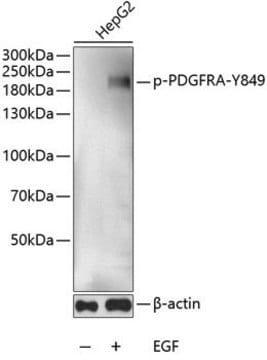 Anti-Phospho-PDGFRA-Y849 antibody produced in rabbit