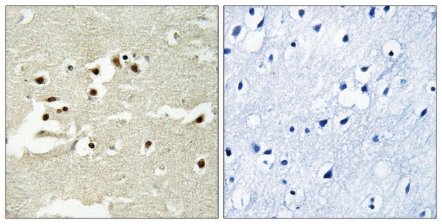 Anti-NCOA5 antibody produced in rabbit affinity isolated antibody