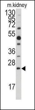 Anti-DUSP18 (C-term) antibody produced in rabbit saturated ammonium sulfate (SAS) precipitated, buffered aqueous solution