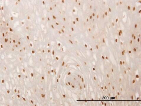 ANTI-SMAD6 antibody produced in mouse clone 4F3, purified immunoglobulin, buffered aqueous solution