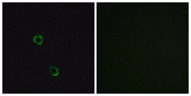 Anti-OR2M2 antibody produced in rabbit affinity isolated antibody