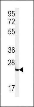 ANTI-FOLR2(N-TERMINAL) antibody produced in rabbit affinity isolated antibody, buffered aqueous solution