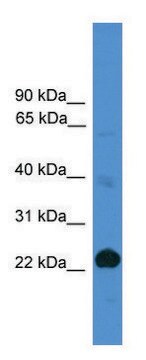 Anti-CD8A antibody produced in rabbit affinity isolated antibody