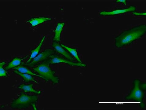 Anti-FBXO42 antibody produced in rabbit purified immunoglobulin, buffered aqueous solution