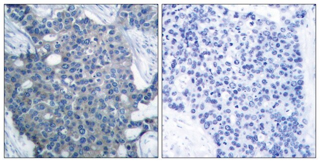 Anti-Stathmin 1 antibody produced in rabbit affinity isolated antibody