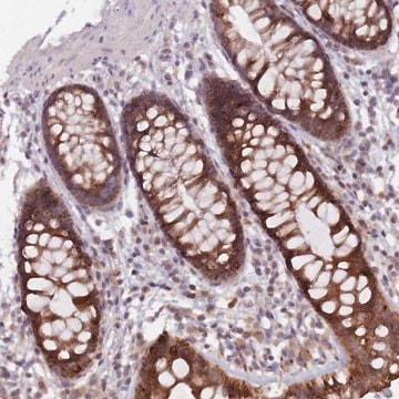 Anti-ADAL antibody produced in rabbit Prestige Antibodies&#174; Powered by Atlas Antibodies, affinity isolated antibody, buffered aqueous glycerol solution