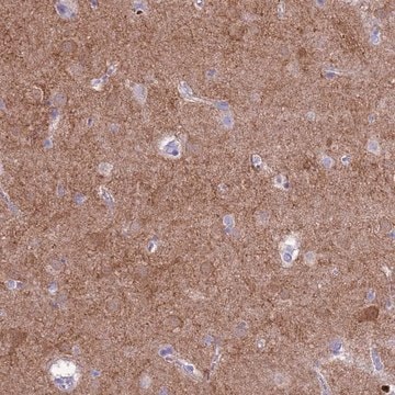 Anti-PDE10A antibody produced in rabbit Prestige Antibodies&#174; Powered by Atlas Antibodies, affinity isolated antibody, buffered aqueous glycerol solution