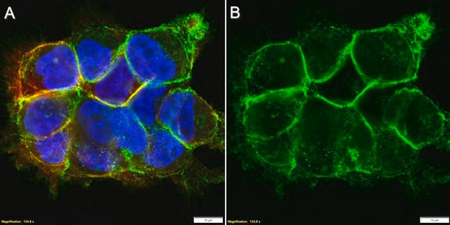 Anti-ITGA3 Antibody, clone P1B5 ZooMAb&#174; Mouse Monoclonal recombinant, expressed in HEK 293 cells