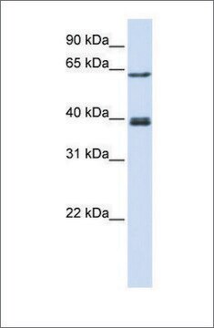 抗IKZF3抗体 ウサギ宿主抗体 affinity isolated antibody