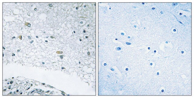 Anti-LAMC3 antibody produced in rabbit affinity isolated antibody